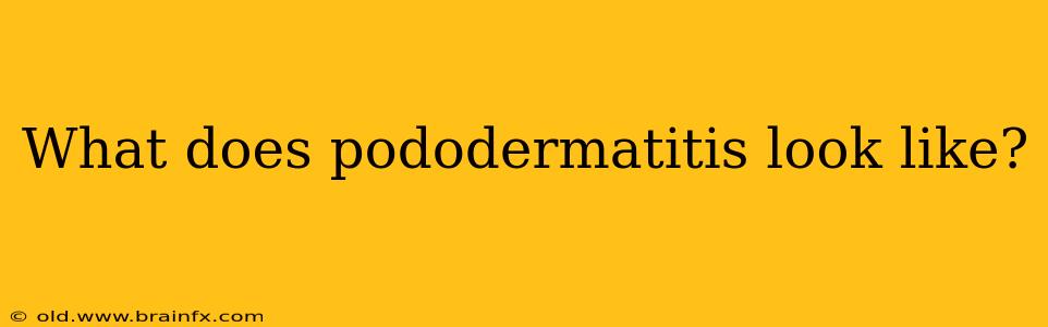 What does pododermatitis look like?